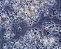 рис. 2 Вид пены в метантенке под микроскопом